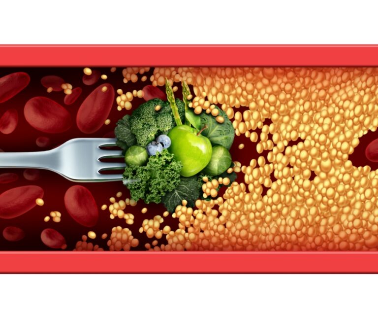 Intensieve training, cholesterol en anabole steroïden: een informatieve gids