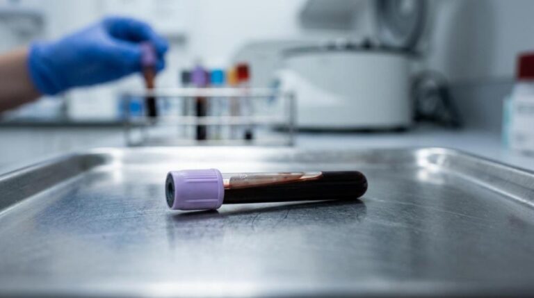 Laboratoriumonderzoek: waar moet je eerst op letten?